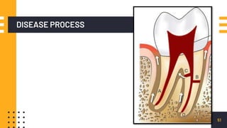 DISEASE PROCESS
51
 