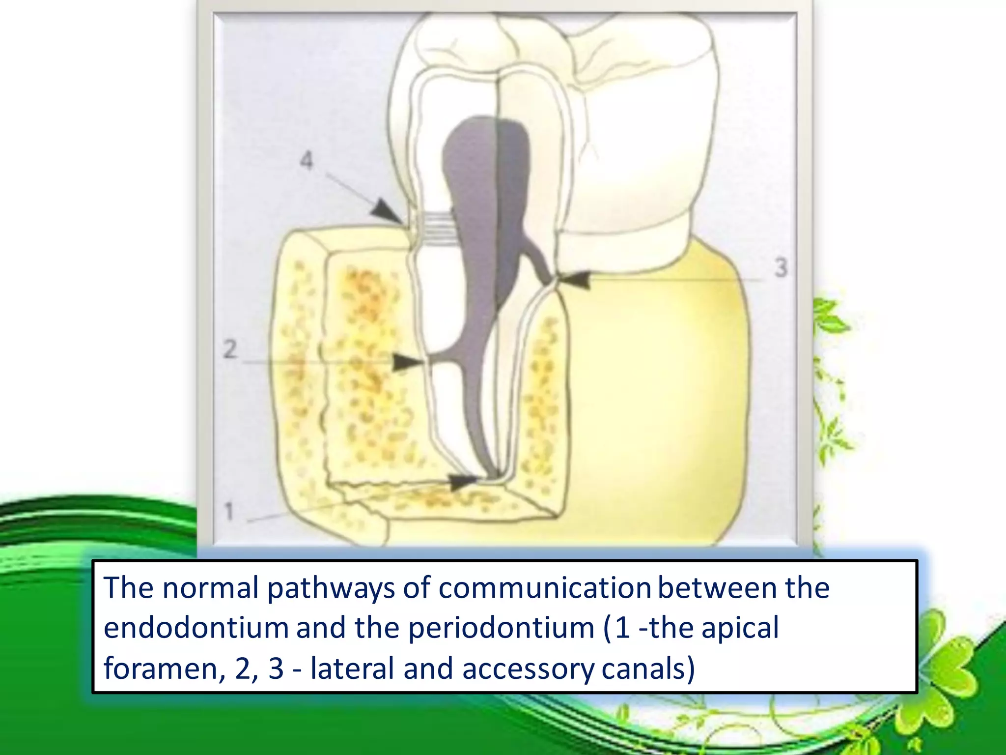 Endo perio lesions