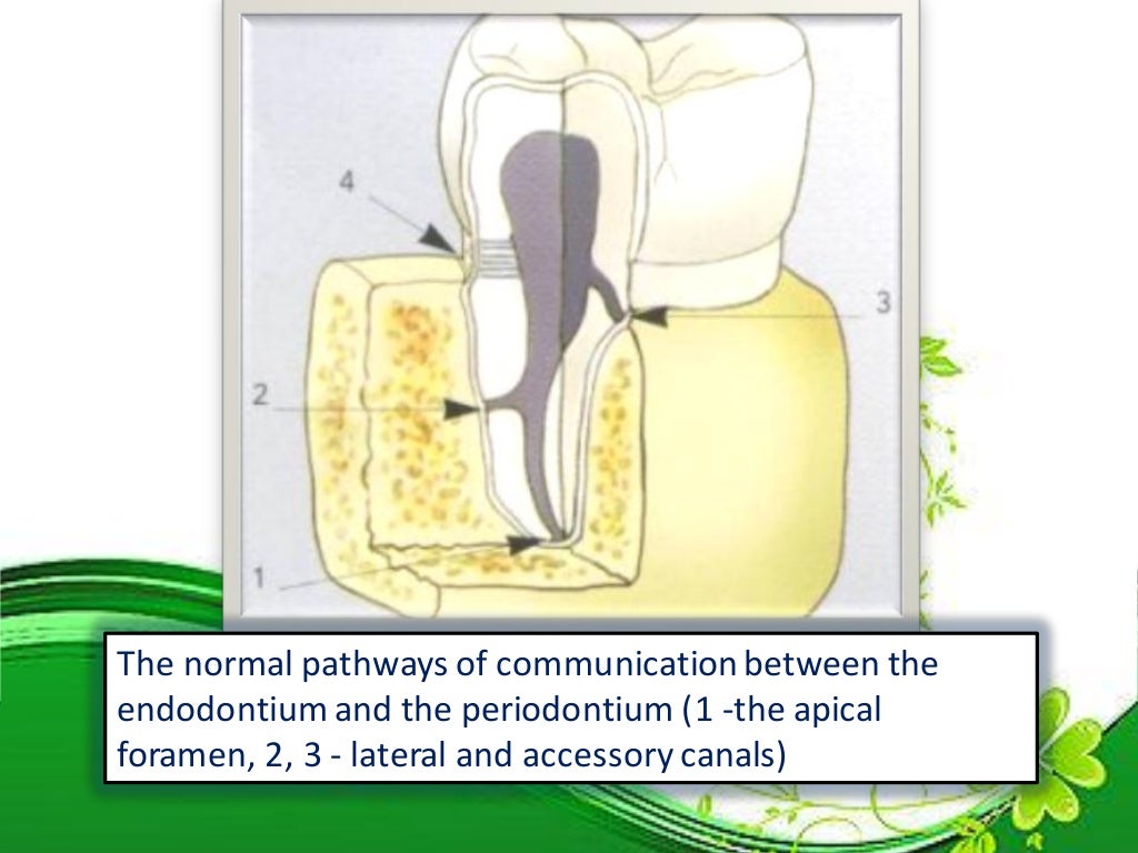 Endo perio lesions