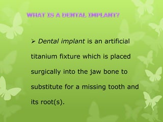  Dental implant is an artificial
titanium fixture which is placed
surgically into the jaw bone to
substitute for a missing tooth and

its root(s).

 