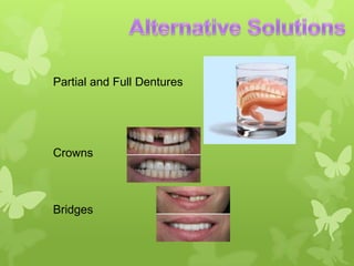 Partial and Full Dentures

Crowns

Bridges

 