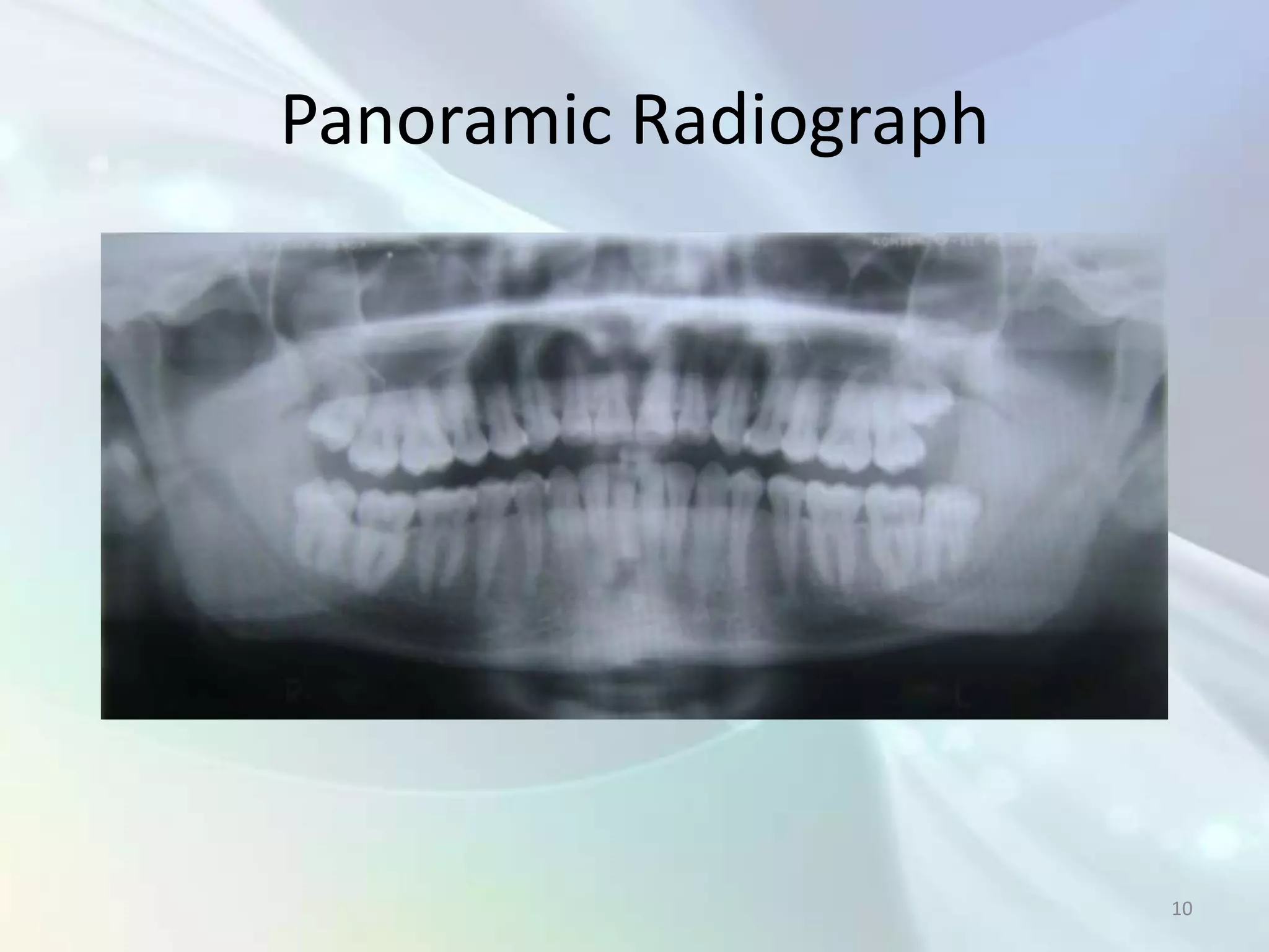 Panoramic Radiograph




                       10
 