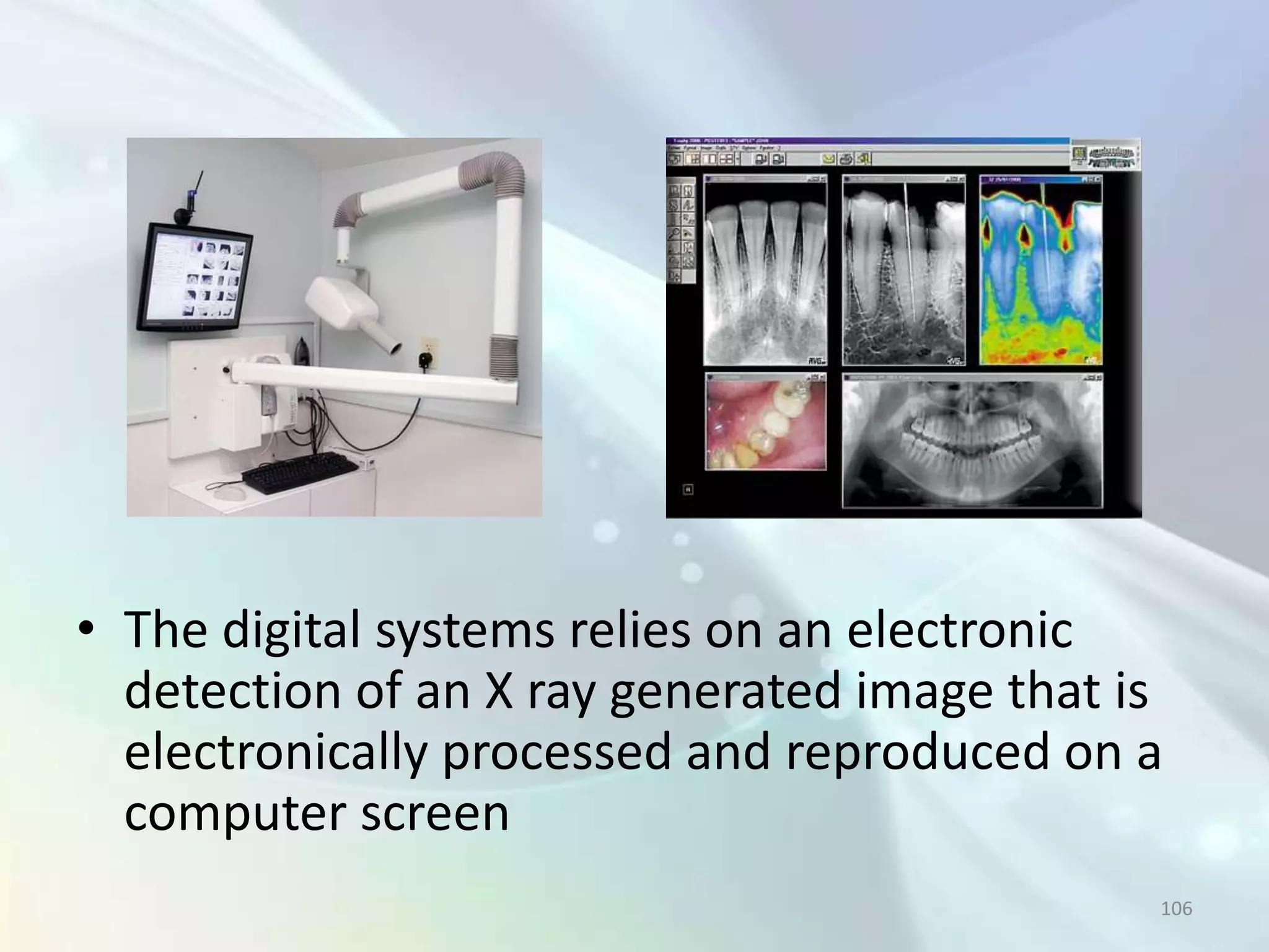 • The digital systems relies on an electronic
  detection of an X ray generated image that is
  electronically processed and reproduced on a
  computer screen
                                              106
 