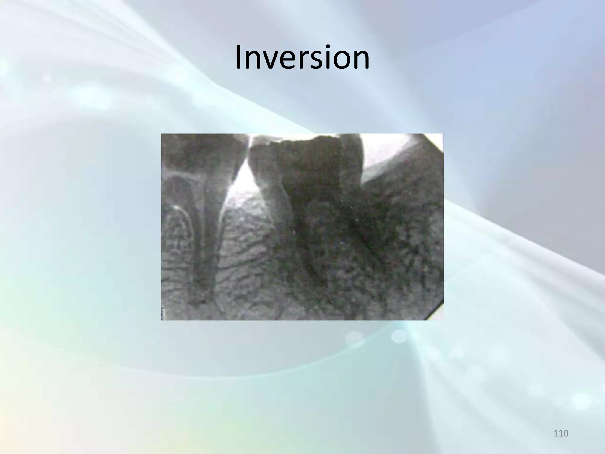 Inversion




            110
 