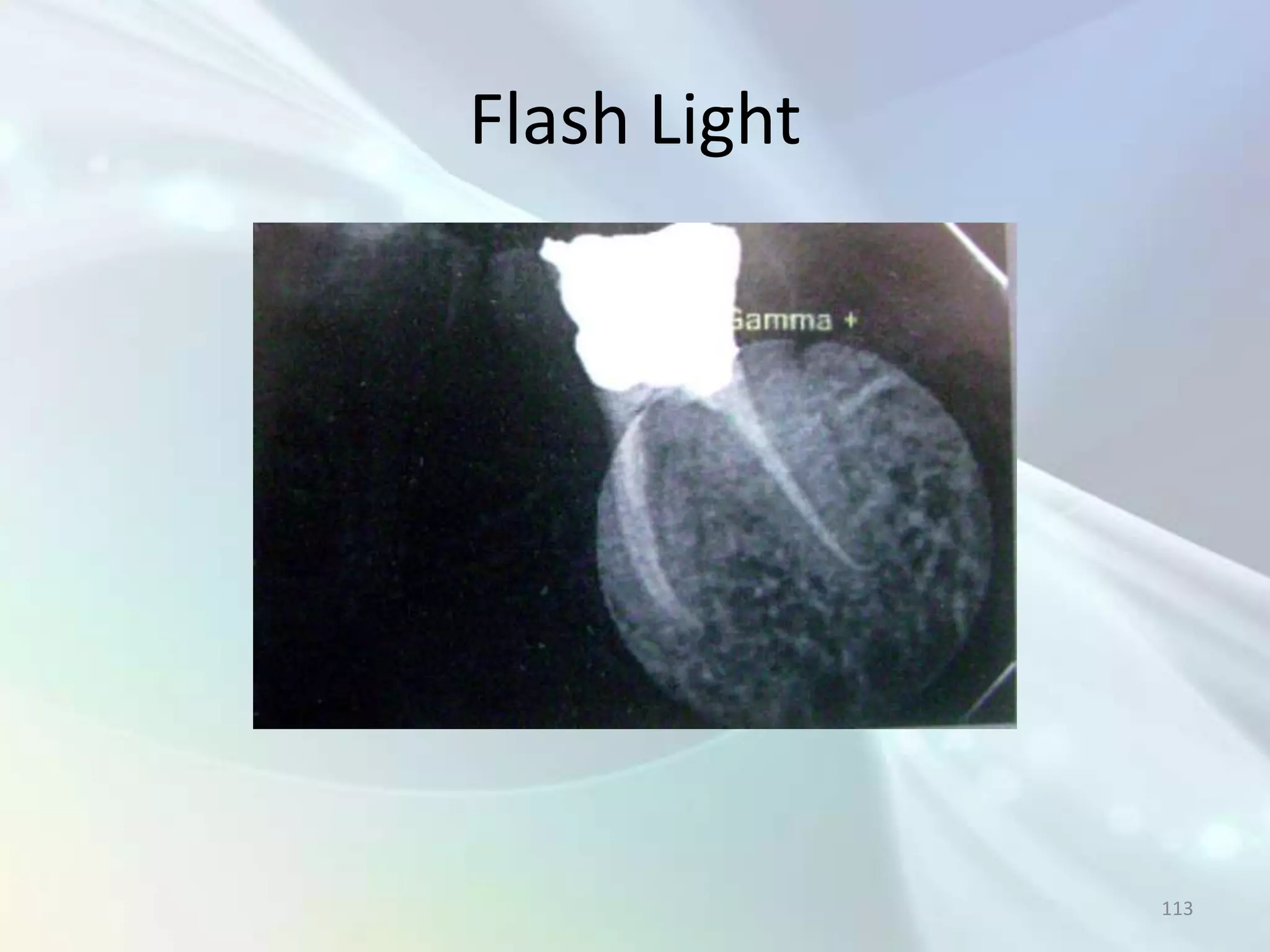 Flash Light




              113
 
