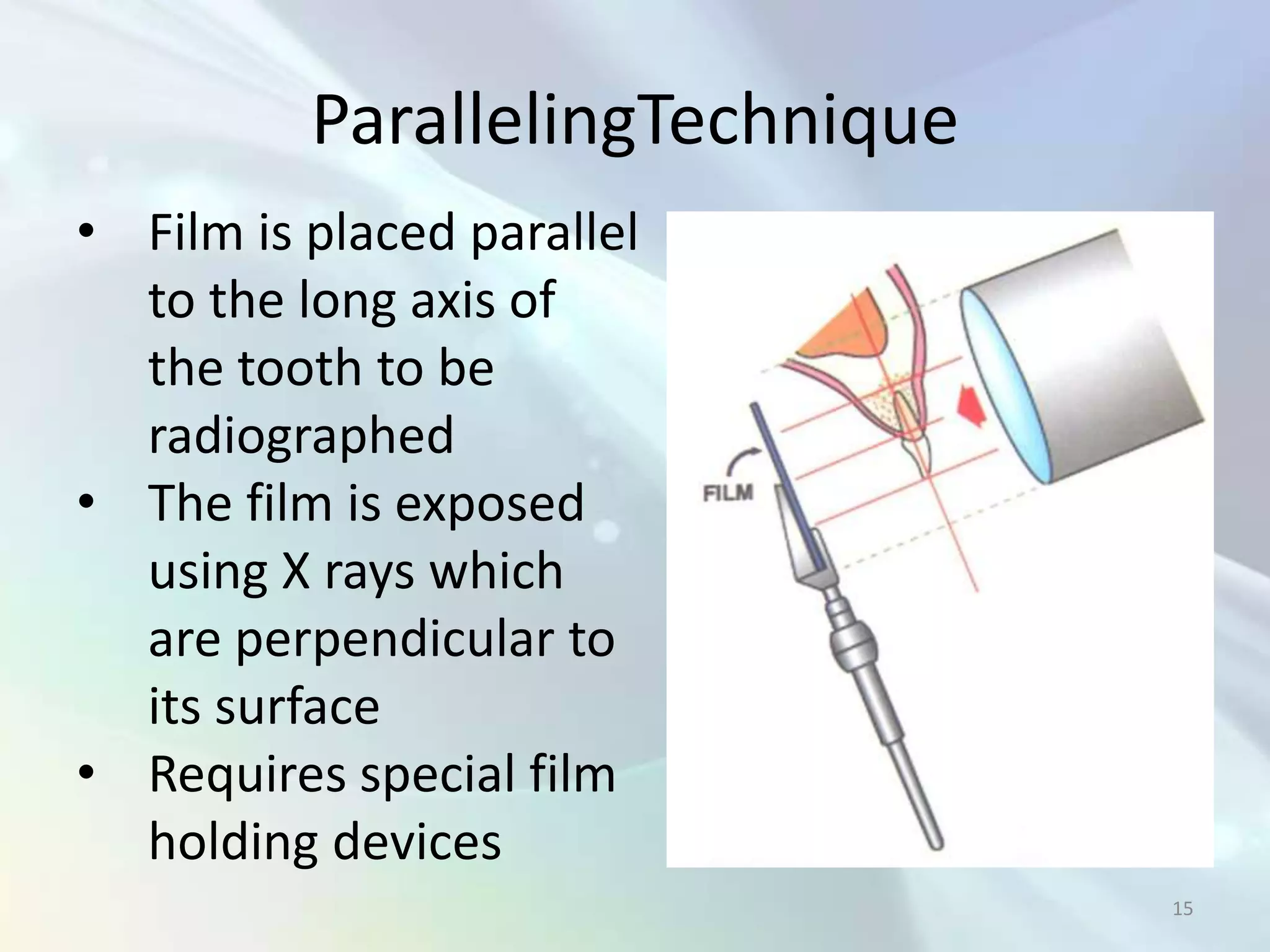 ParallelingTechnique
• Film is placed parallel
  to the long axis of
  the tooth to be
  radiographed
• The film is exposed
  using X rays which
  are perpendicular to
  its surface
• Requires special film
  holding devices
                                 15
 