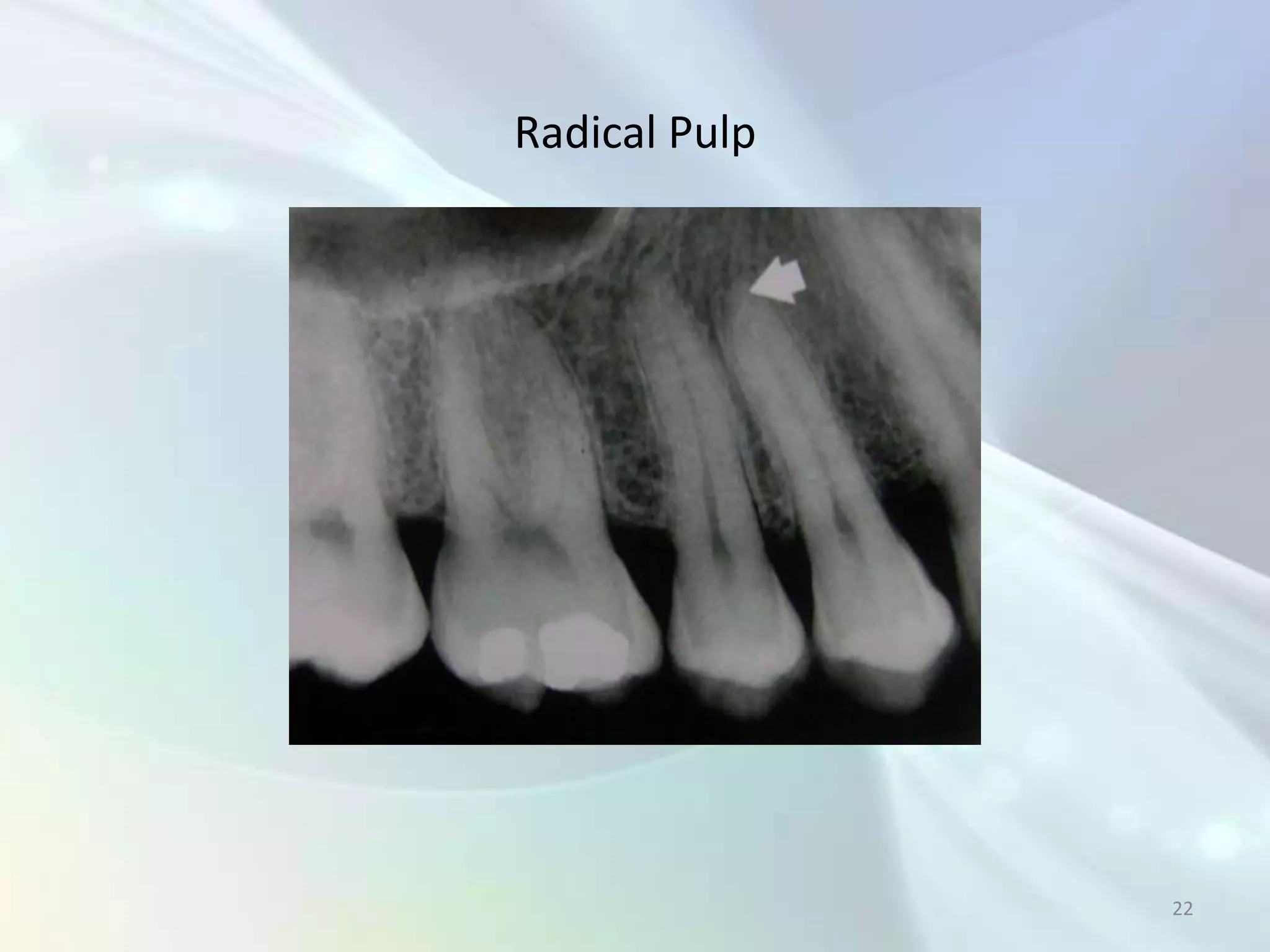 Radical Pulp




               22
 