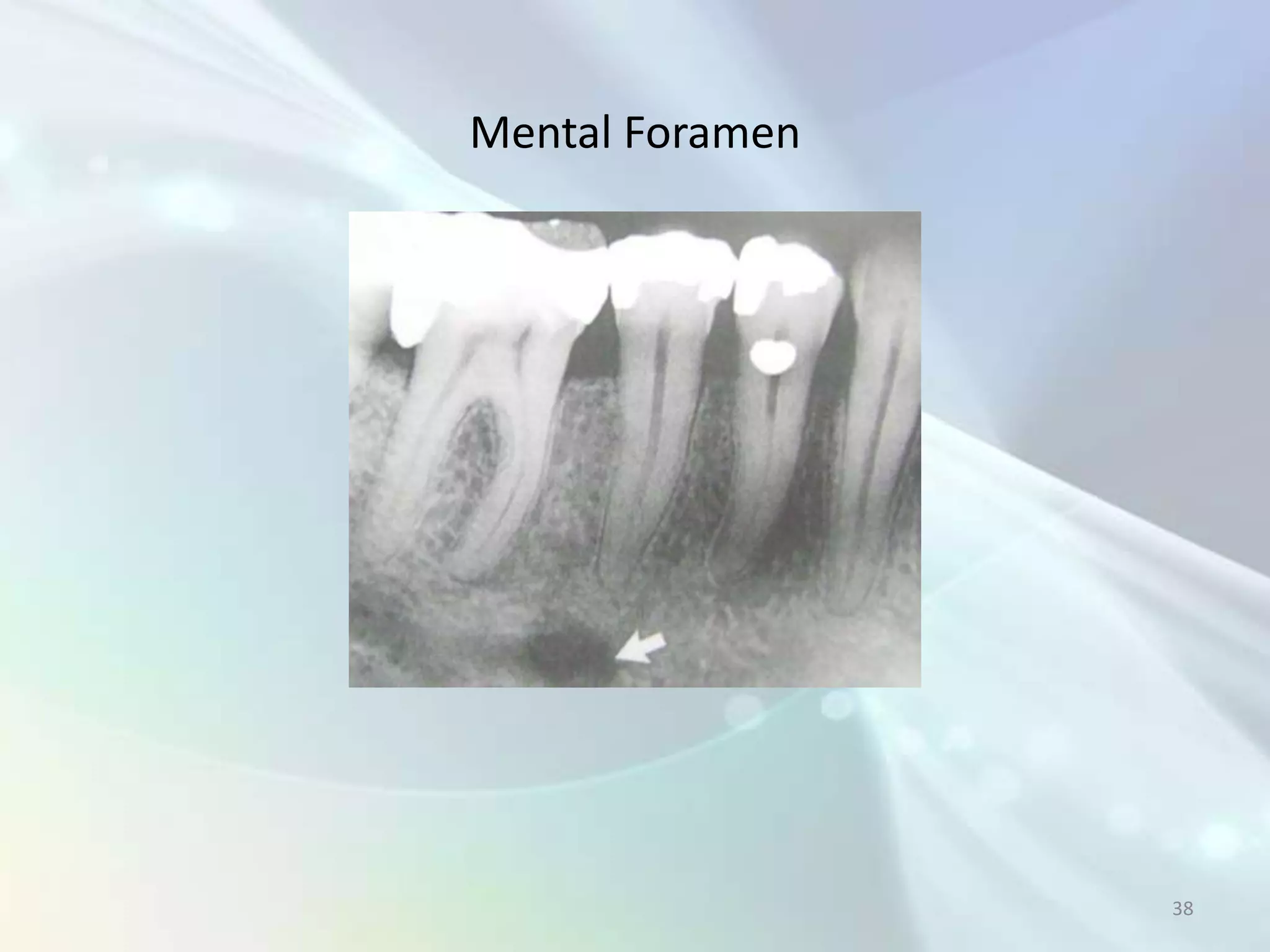 Mental Foramen




                 38
 