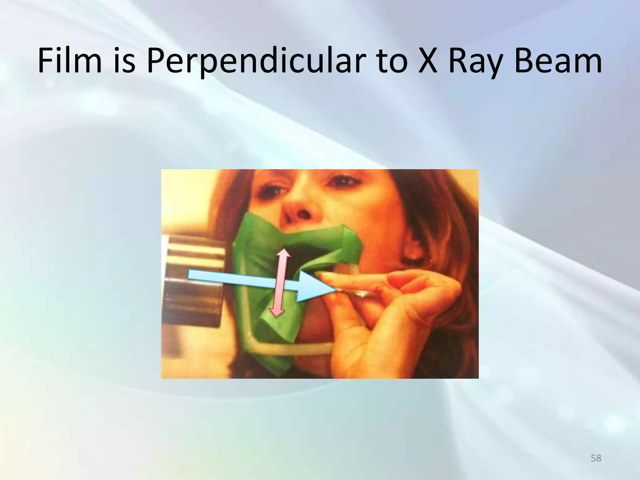 Film is Perpendicular to X Ray Beam




                                  58
 