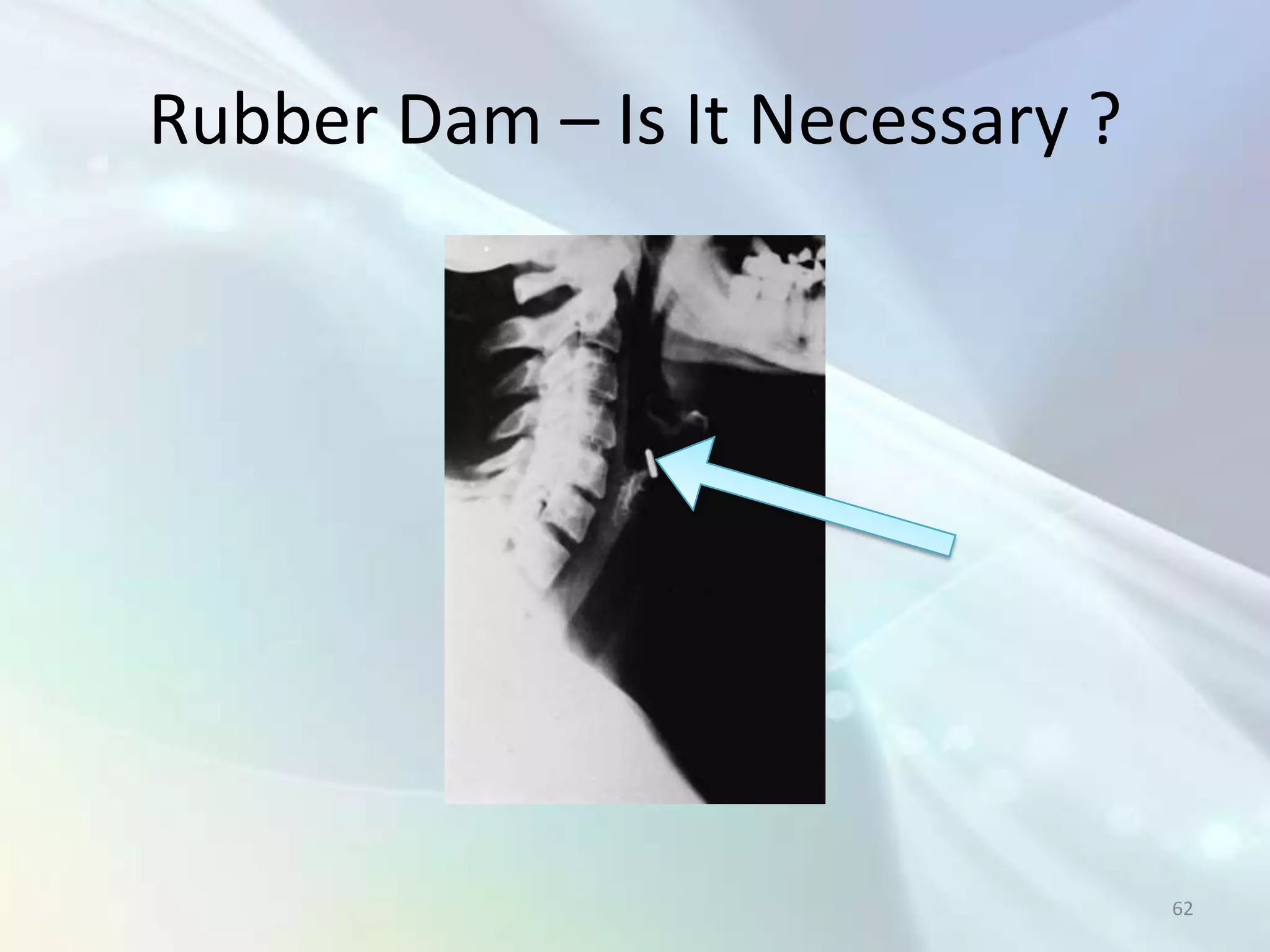 Rubber Dam – Is It Necessary ?




                                 62
 