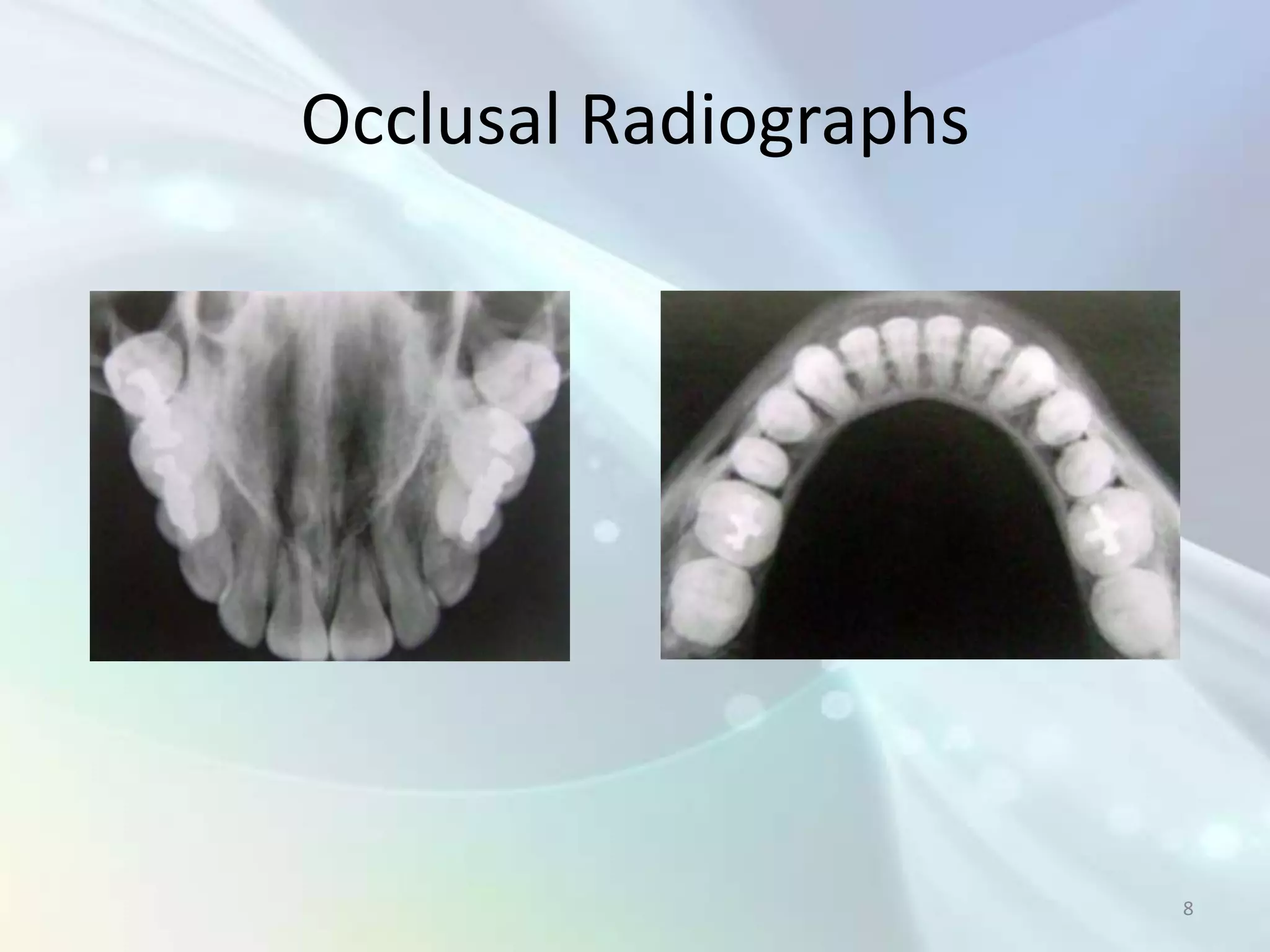 Occlusal Radiographs




                       8
 