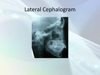 Radiology in Endodontics | PPTX