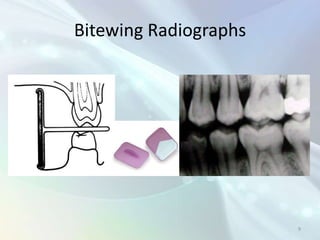 Radiology in Endodontics | PPTX