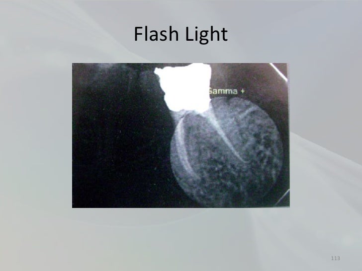 Radiology in Endodontics