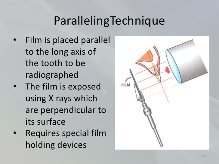 Radiology in Endodontics