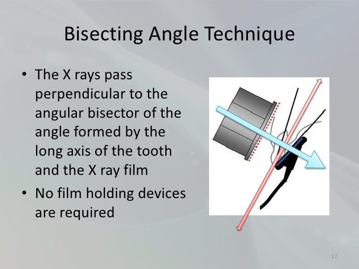 Radiology in Endodontics