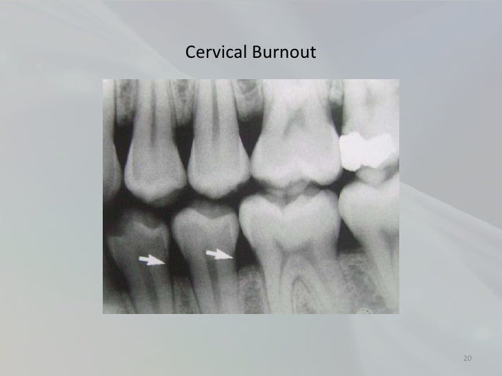 Radiology in Endodontics