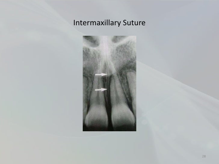 Radiology in Endodontics