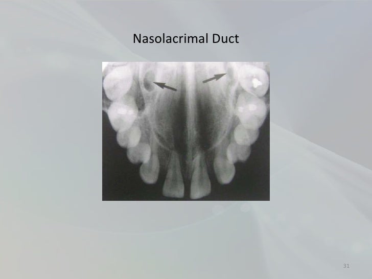 Radiology in Endodontics
