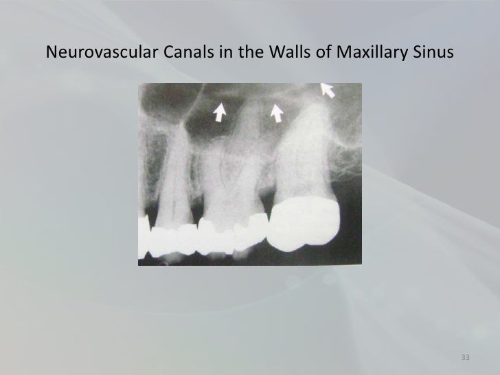 Radiology in Endodontics