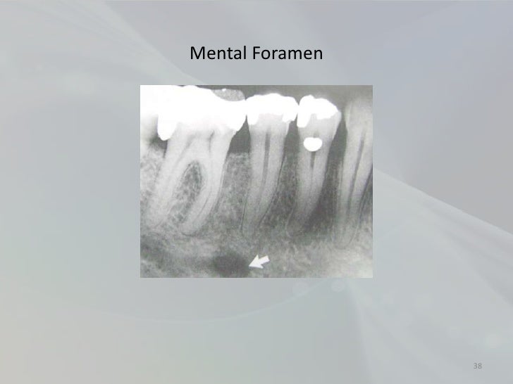 Radiology in Endodontics