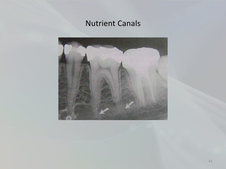 radiology-in-endodontics-42-728.jpg?cb=1