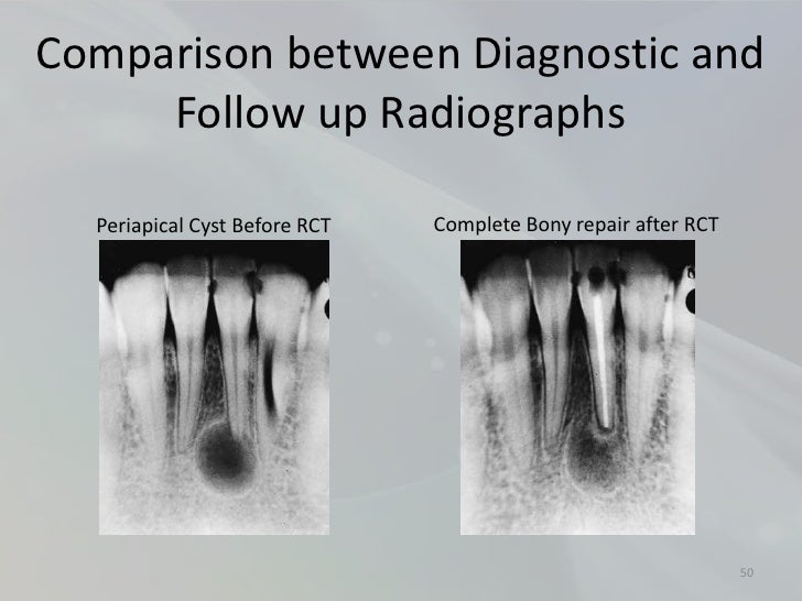 Radiology in Endodontics