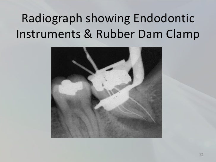 Radiology in Endodontics