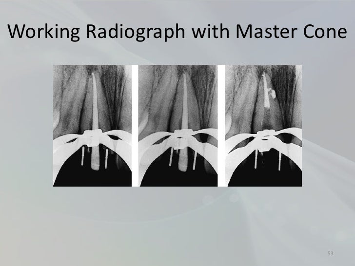 Radiology in Endodontics