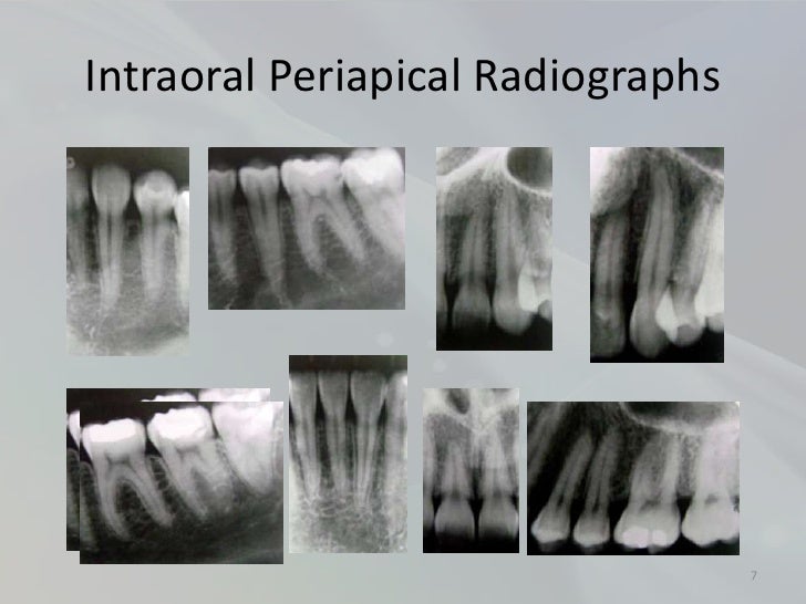 Radiology in Endodontics