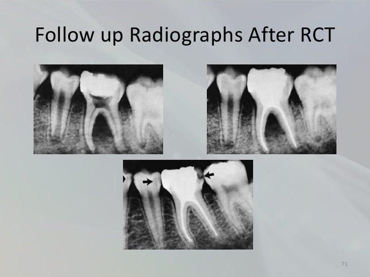 Radiology in Endodontics