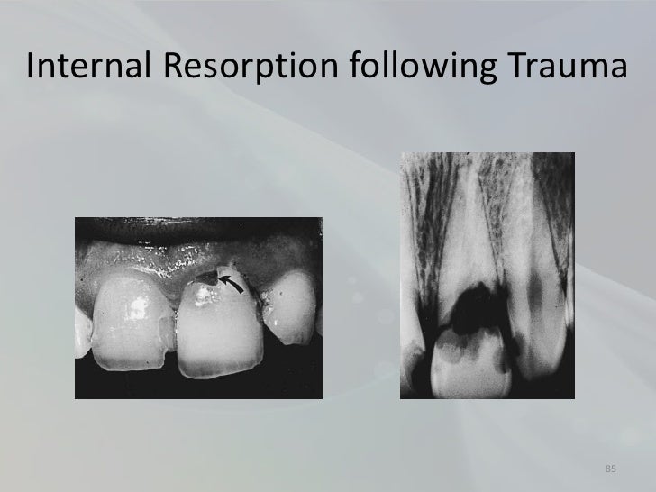 Radiology in Endodontics