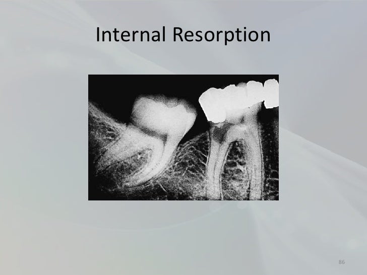 Radiology in Endodontics