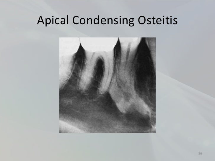 Radiology in Endodontics