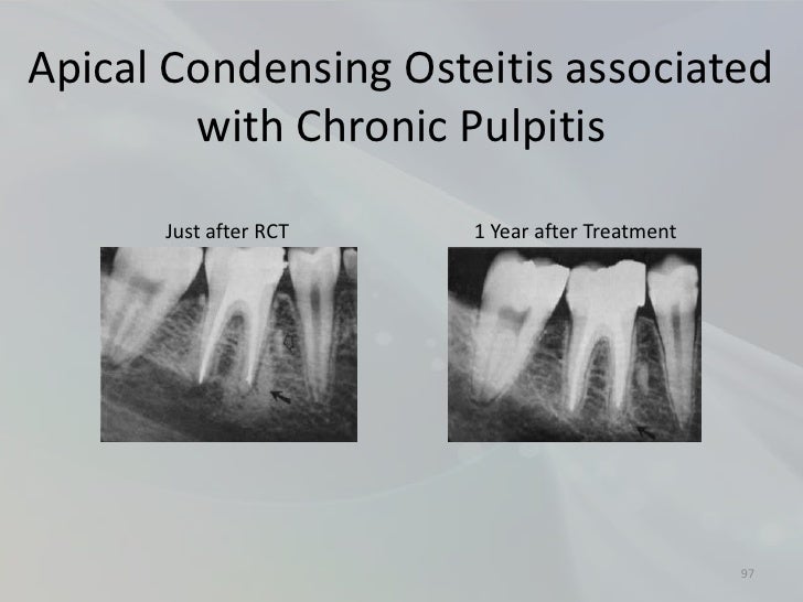 Radiology in Endodontics
