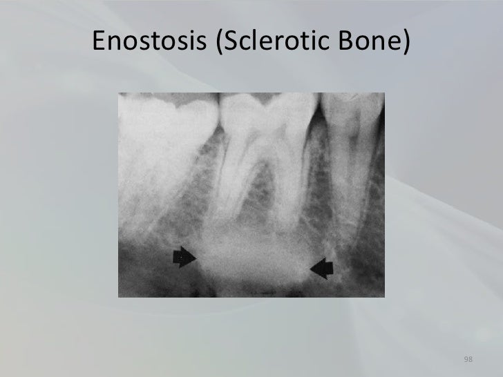 Radiology in Endodontics