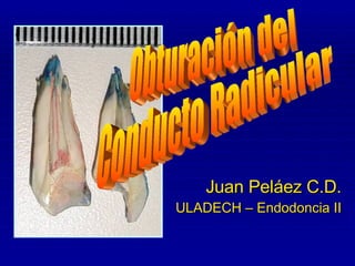 Obturación del Conducto Radicular Juan Peláez C.D. ULADECH – Endodoncia II Obturación del  Conducto Radicular 