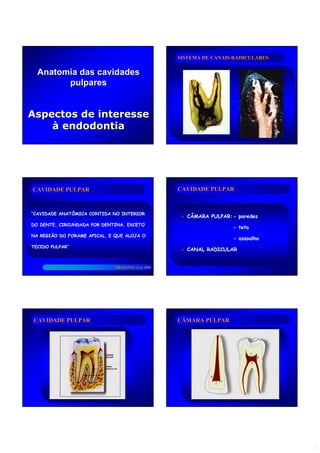 11
AnatomiaAnatomia dasdas cavidadescavidades
pulparespulpares
AspectosAspectos dede interesseinteresse
àà endodontiaendodontia
SISTEMA DE CANAIS RADICULARESSISTEMA DE CANAIS RADICULARES
CAVIDADE PULPARCAVIDADE PULPAR
“CAVIDADE ANATÔMICA CONTIDA NO INTERIOR
DO DENTE, CIRCUNDADA POR DENTINA, EXCETO
NA REGIÃO DO FORAME APICAL, E QUE ALOJA O
TECIDO PULPAR”
BRAMANTE,BRAMANTE, etet al. 2000al. 2000
CAVIDADE PULPARCAVIDADE PULPAR
CÂMARA PULPAR:- paredes
- teto
- assoalho
CANAL RADICULAR
CAVIDADE PULPARCAVIDADE PULPAR CÂMARA PULPARCÂMARA PULPAR
 