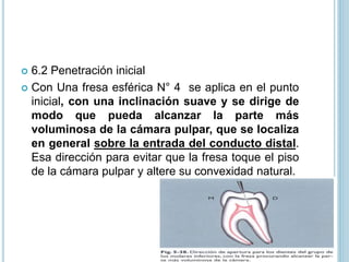  6.2 Penetración inicial
 Con Una fresa esférica N° 4 se aplica en el punto
inicial, con una inclinación suave y se dirige de
modo que pueda alcanzar la parte más
voluminosa de la cámara pulpar, que se localiza
en general sobre la entrada del conducto distal.
Esa dirección para evitar que la fresa toque el piso
de la cámara pulpar y altere su convexidad natural.
 