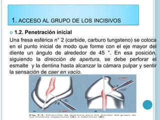  1.2. Penetración inicial
Una fresa esférica n° 2 (carbide, carburo tungsteno) se coloca
en el punto inicial de modo que forme con el eje mayor del
diente un ángulo de alrededor de 45 °. En esa posición,
siguiendo la dirección de apertura, se debe perforar el
esmalte y la dentina hasta alcanzar la cámara pulpar y sentir
la sensación de caer en vacío.
1. ACCESO AL GRUPO DE LOS INCISIVOS
 