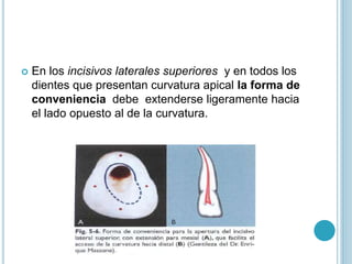  En los incisivos laterales superiores y en todos los
dientes que presentan curvatura apical la forma de
conveniencia debe extenderse ligeramente hacia
el lado opuesto al de la curvatura.
 
