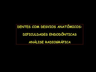 DENTES COM DESVIOS ANATÔMICOS:

  DIFICULDADES ENDODÔNTICAS

     ANÁLISE RADIOGRÁFICA
 