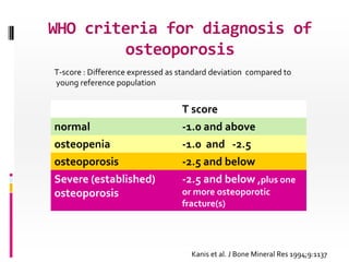WHO classification with a T-score cannot be
applied to:

• premenopausal women
• men under age 50
• children

Z score

Low...