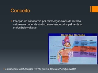 Conceito
 Infecção do endocárdio por microorganismos de diversa
natureza e poder destrutivo envolvendo principalmente o
endocárdio valvular.
 European Heart Journal (2015) doi:10.1093/eurheartj/ehv319
 