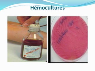 Hémocultures
 