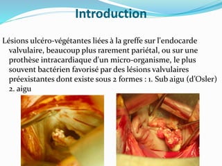 Introduction
Lésions ulcéro-végétantes liées à la greffe sur l'endocarde
valvulaire, beaucoup plus rarement pariétal, ou sur une
prothèse intracardiaque d'un micro-organisme, le plus
souvent bactérien favorisé par des lésions valvulaires
préexistantes dont existe sous 2 formes : 1. Sub aigu (d’Osler)
2. aigu
 