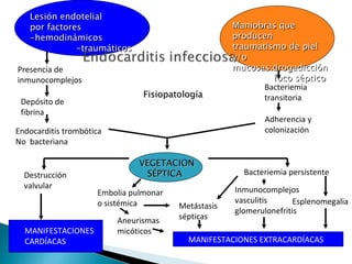 Lesión endotelial
   por factores                                      Maniobras que
   -hemodinámicos                                    producen
              -traumáticos                           traumatismo de piel
                                                     y/o
Presencia de                                         mucosas:drogadicción
inmunocomplejos                                                foco séptico
                                                            Bacteriemia
                                Fisiopatología              transitoria
 Depósito de
 fibrina
                                                            Adherencia y
Endocarditis trombótica                                     colonización
No bacteriana

                               VEGETACION
  Destrucción                    SÉPTICA               Bacteriemia persistente
  valvular                                           Inmunocomplejos
                     Embolia pulmonar
                     o sistémica                     vasculitis      Esplenomegalia
                                        Metástasis
                                                     glomerulonefritis
                          Aneurismas    sépticas
  MANIFESTACIONES         micóticos
  CARDÍACAS                               MANIFESTACIONES EXTRACARDÍACAS
 