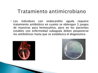    Los individuos con endocarditis aguda requiere
    tratamiento antibiótico en cuanto se obtengan 3 juegos
    de muestras para hemocultivo, pero en los pacientes
    estables con enfermedad subaguda deben posponerse
    los antibióticos hasta que se establezca el diagnostico.
 