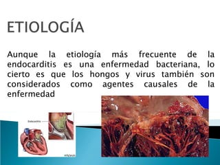 Aunque la etiología más frecuente de la
endocarditis es una enfermedad bacteriana, lo
cierto es que los hongos y virus también son
considerados como agentes causales de la
enfermedad
 