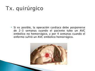    Si es posible, la operación cardiaca debe posponerse
    de 2-3 semanas cuando el paciente tubo un AVC
    embolico no hemorrágico, y por 4 semanas cuando el
    enfermo sufrió un AVC embolico hemorrágico.
 